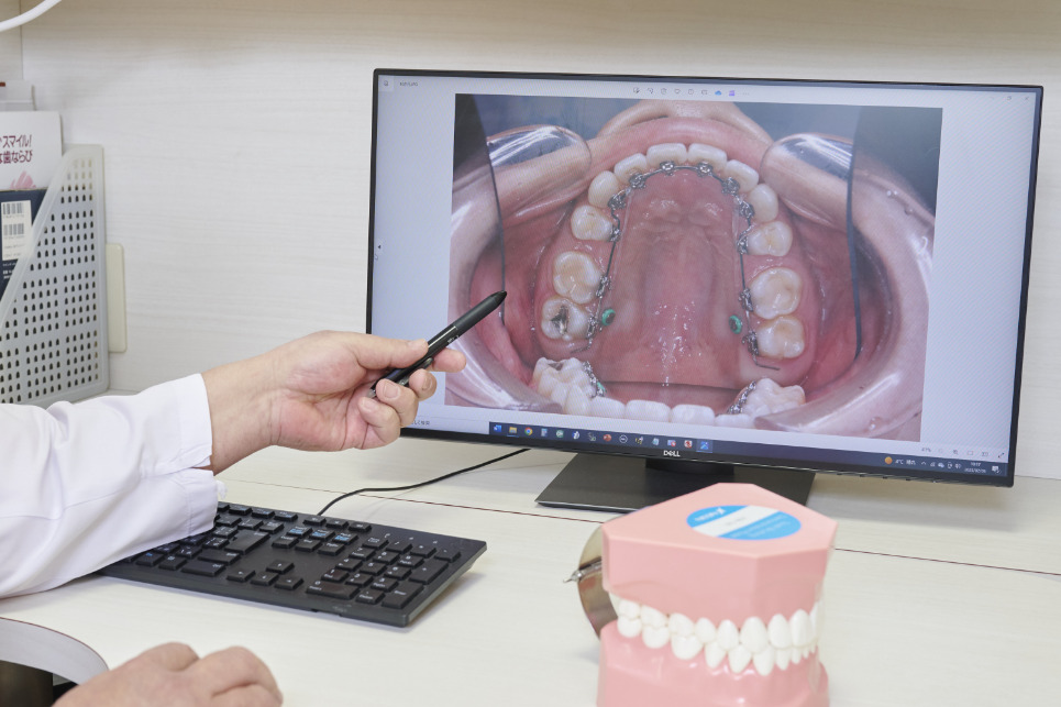 診断用コンピューター画像