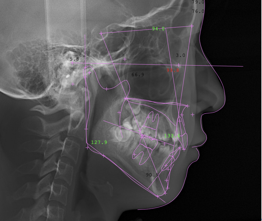 頭部X線規格写真「セファロ」​